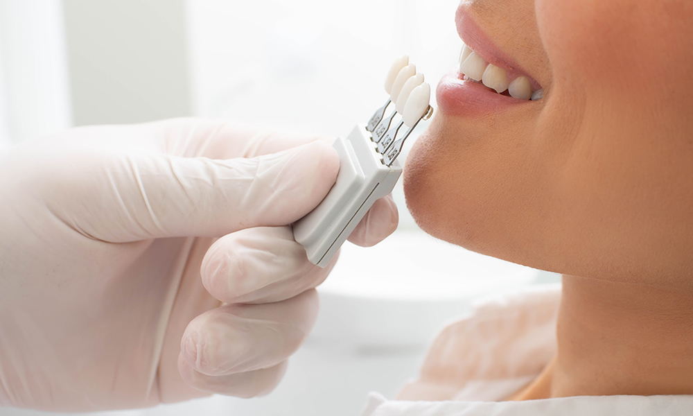 Dentist in Hornchurch Expert Private & NHS Dental Care Top Rated