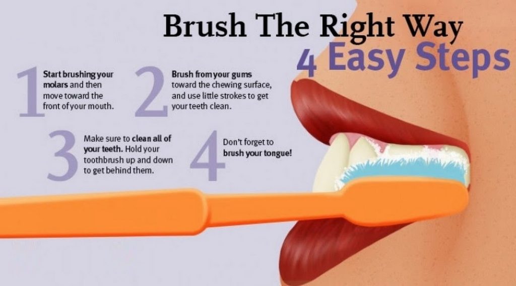 How to Get the Best Teeth Whitening and Fast Results Harrow Dental