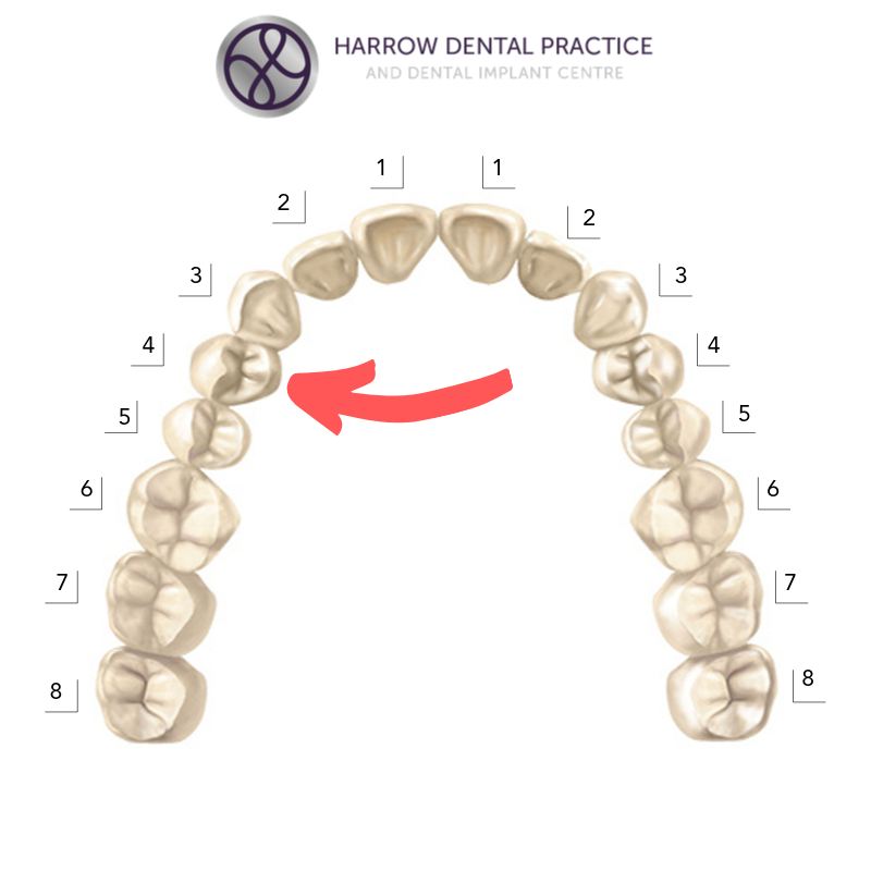 1st premolar tooth notation