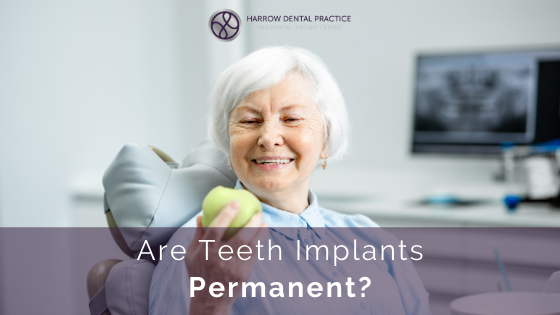 Are Teeth Implants Permanent?