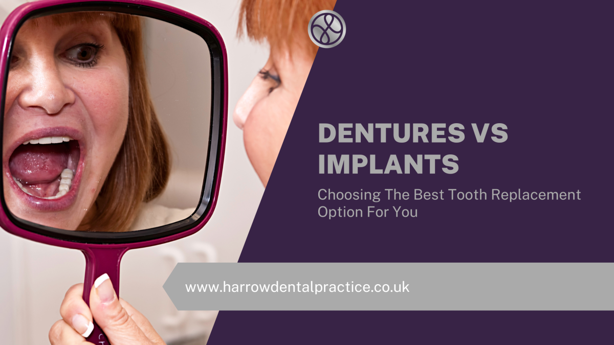 Dentures Vs Implants – Choosing The Best Tooth Replacement Option For You
