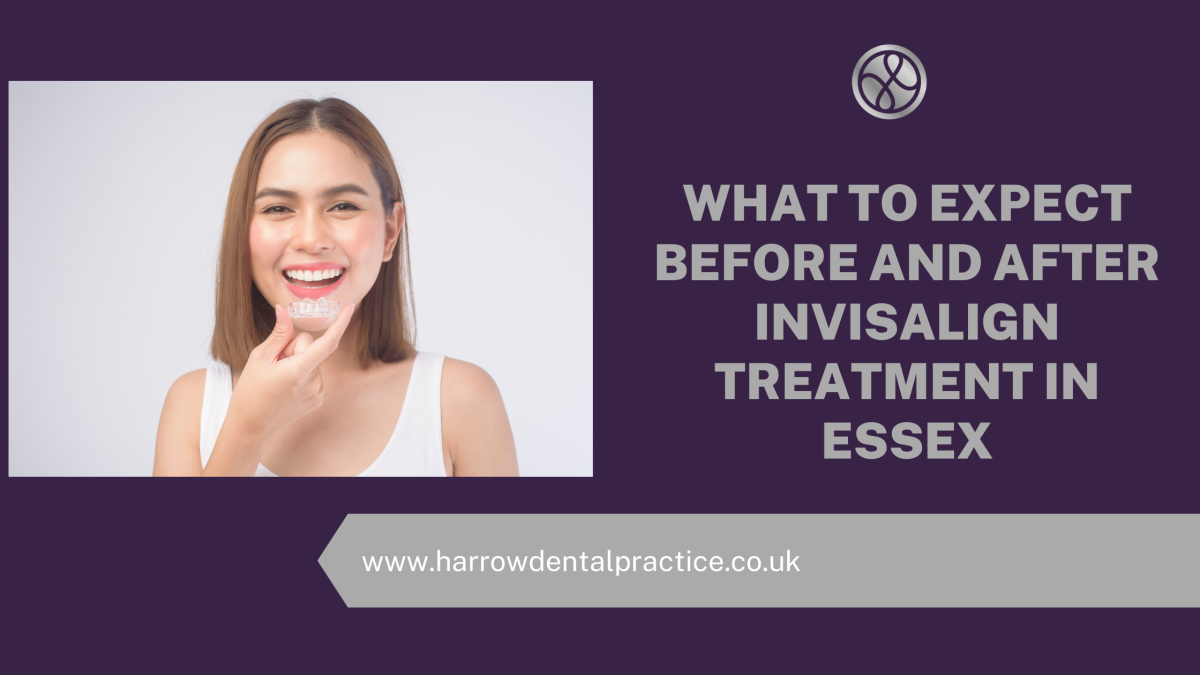 What To Expect Before And After Invisalign Treatment In Essex?￼