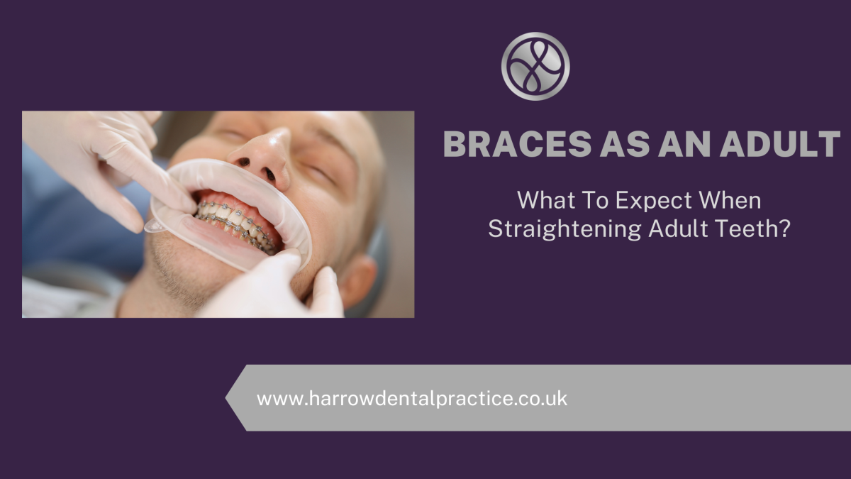 Braces As An Adult – What To Expect When Straightening Adult Teeth?