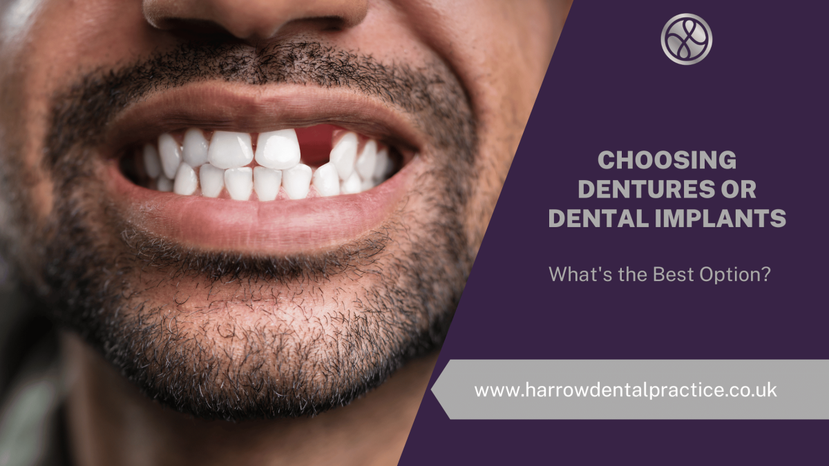 Dentures Or Dental Implants